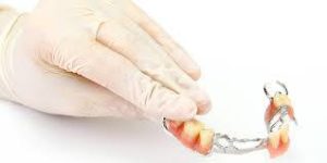 Hand with gloves holding partial dental crowns