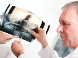 Dentist sharing dental x-ray results
